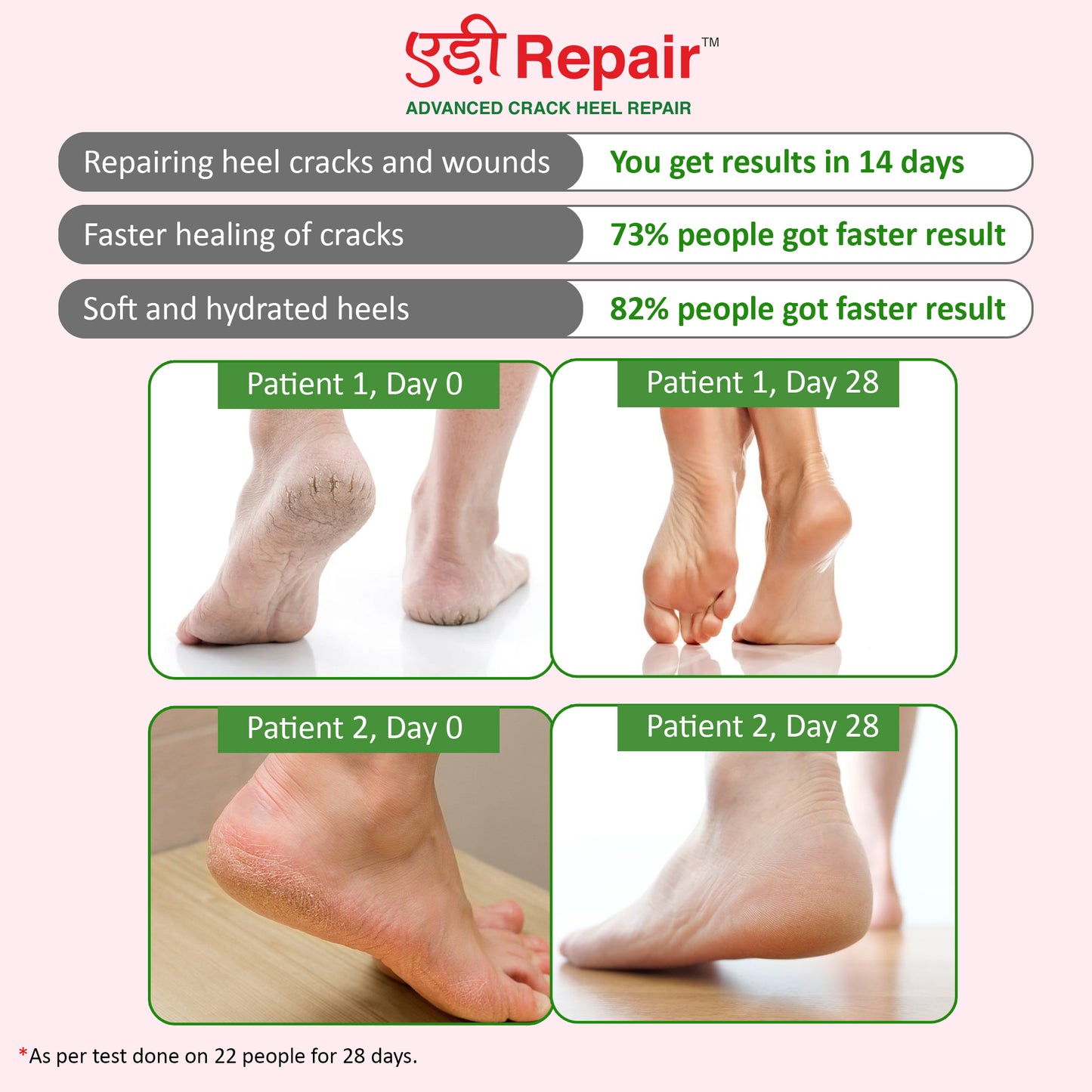 Nimson Advanced Crack Heel Repair Cream – Restores Soft, Smooth Feet